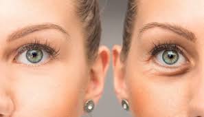 درمان سریع ورم چشم با روش های خانگی